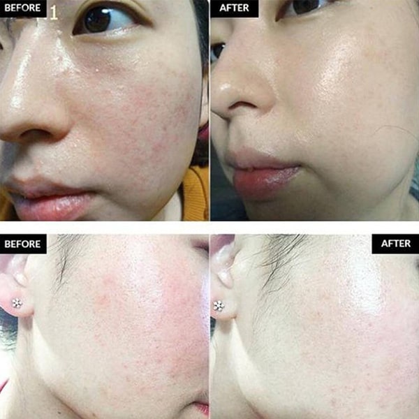 Tinh Chất Dear Klairs Phục Hồi Da